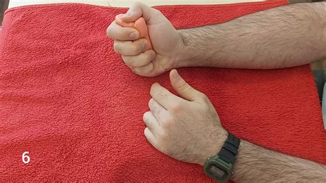 parmakların deforme edici artrozu nasıl tedavi edilir
